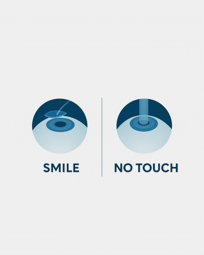 Refraktif Cerrahide İki Modern Yaklaşım: SMILE ve No Touch Lazer