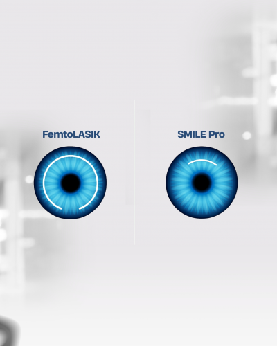 SMILE Pro mu FemtoLASIK mi? Hangisi Sizin İçin Uygun?